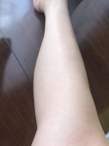 This is my legs after using the Epilat Hair Removing Body Cream. My legs became soft and supple without hair!